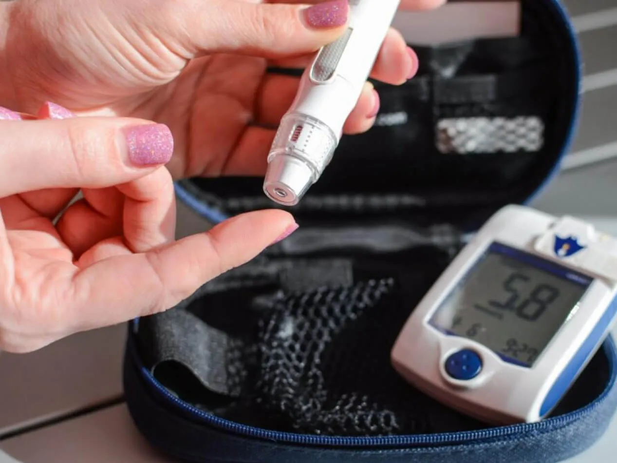 Diabete tipo 2 glicemia.net Diabete mellito tipo 2 glicemia.net
