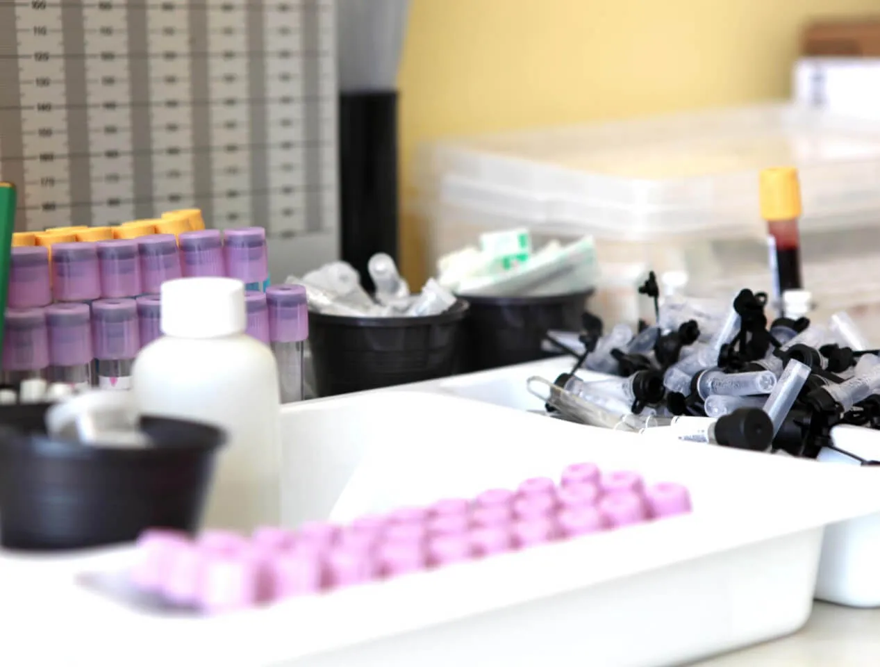Come si diagnostica l'ipoglicemia Come si diagnostica l'ipoglicemia