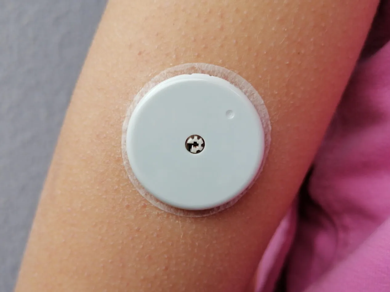 CGM o glucometro CGM o glucometro