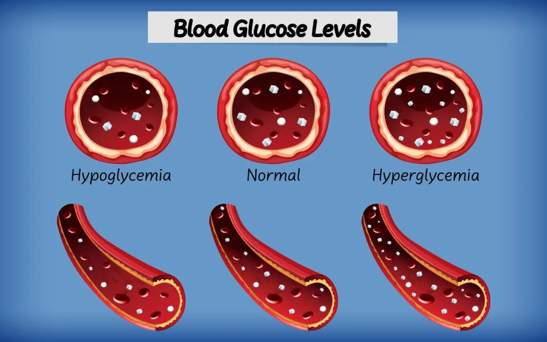 Cosa mangiare con la glicemia bassa